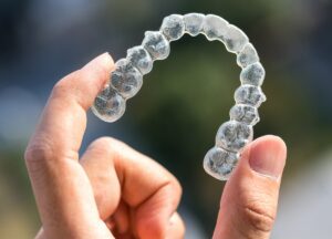 Invisalign 101 EverythingYou Needto Know