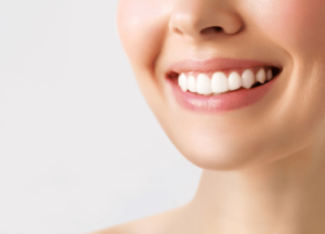 Cosmetic Bonding or Veneers What to Choose