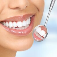 Keeping Your Teeth Bright After Cosmetic Treatment