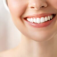 How to Whiten Your Teeth for the Holidays